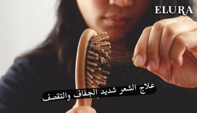 علاج الشعر شديد الجفاف والتقصف