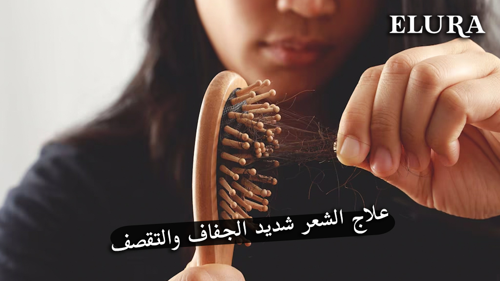 علاج الشعر شديد الجفاف والتقصف