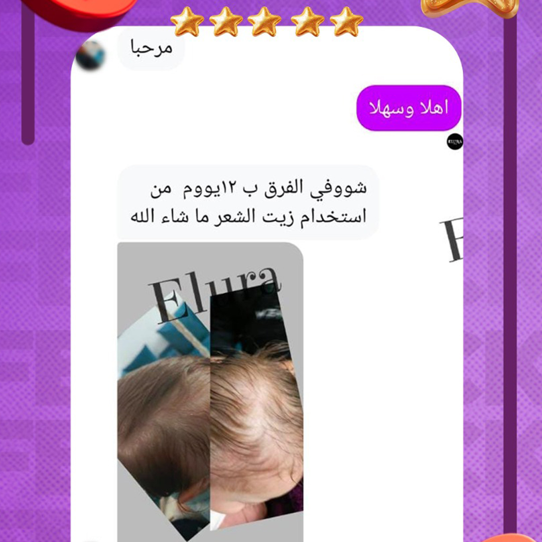 زيت روزماري للشعر